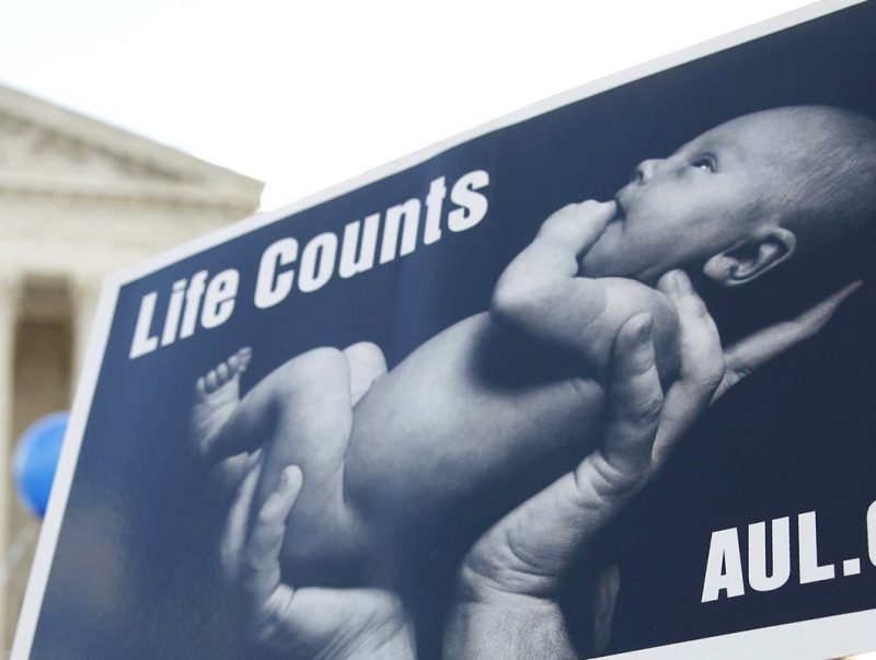 A pro-life supporter holds up a sign in front of the U.S. Supreme Court in Washington March 2 on the morning the court heard oral arguments in a challenge to a Texas law imposing new standards on abortion clinics and requiring abortion doctors to have hospital admitting privileges. (CNS photo/Kevin Lamarque, Reuters) See SCOTUS-TEXAS-ABORTION March 2, 2016.